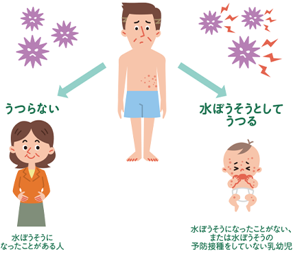 帯状疱疹は水ぼうそうになったことがある人にはうつらないが、水ぼうそうになったことのない、もしくは水ぼうそうの予防接種をしていない乳幼児には水ぼうそうとしてうつす可能性がある