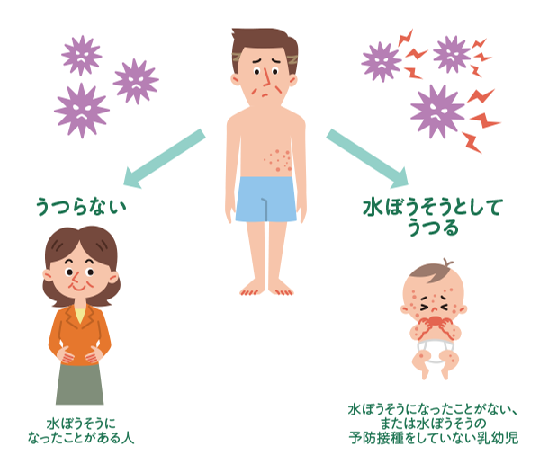 帯状疱疹は水ぼうそうになったことがある人にはうつらないが、水ぼうそうになったことのない、もしくは水ぼうそうの予防接種をしていない乳幼児には水ぼうそうとしてうつす可能性がある