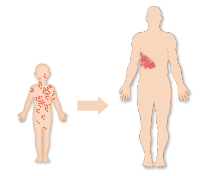 水ぼうそうが治った後も体内に潜んでいたウイルスが、帯状疱疹として発症します